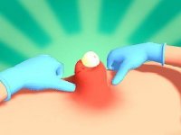 Pimple Squeeze: Pop & Zap ASMR Game